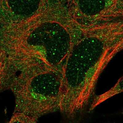 Immunocytochemistry/ Immunofluorescence: GTP-binding protein 1 Antibody [NBP2-56040]