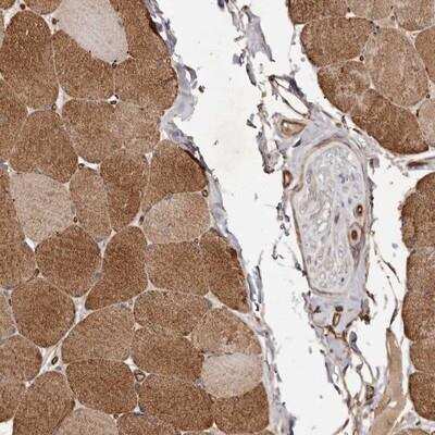 Immunohistochemistry: GTP-binding protein 1 Antibody [NBP1-89746]