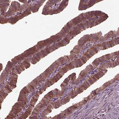 Immunohistochemistry-Paraffin: GTP-binding protein 1 Antibody [NBP2-56040]