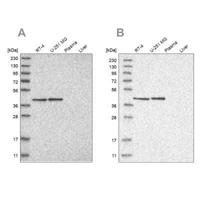 Western Blot: GTP binding protein era homolog Antibody [NBP1-89703]