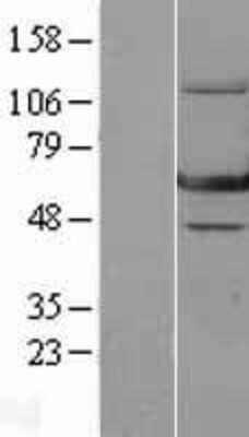 Western Blot: GTP binding protein era homolog Overexpression Lysate [NBL1-10309]