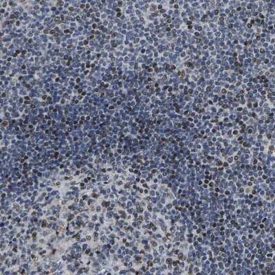 Immunohistochemistry-Paraffin: GTPBP10 Antibody [NBP1-85055]