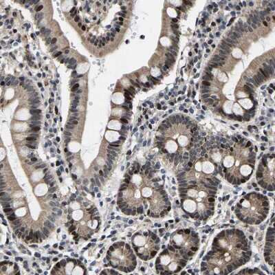 Immunohistochemistry-Paraffin: GTPBP10 Antibody [NBP1-85055]