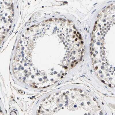 Immunohistochemistry-Paraffin: GTPBP10 Antibody [NBP1-85055]