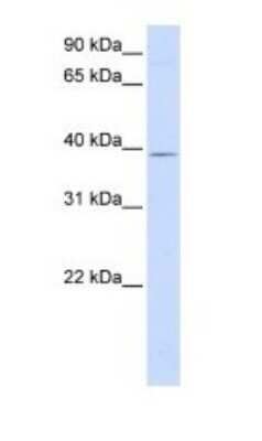 Western Blot: GTPBP10 Antibody [NBP1-52959]