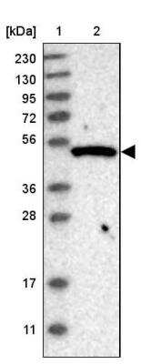 Western Blot: GTPBP10 Antibody [NBP1-85055]