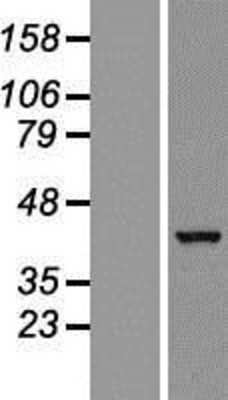 Western Blot: GTPBP10 Overexpression Lysate [NBL1-11398]