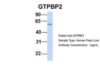 Western Blot: GTPBP2 Antibody [NBP1-57648]