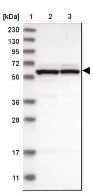 Western Blot: GTPBP2 Antibody [NBP1-85924]