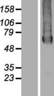 Western Blot: GTPBP2 Overexpression Lysate [NBP2-06722]