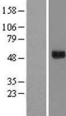 Western Blot: GTPBP3 Overexpression Lysate [NBL1-11400]