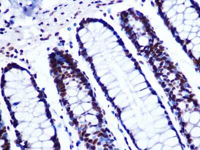 Immunohistochemistry-Paraffin: GTPBP4 Antibody (7O5L6) [NBP3-16476]