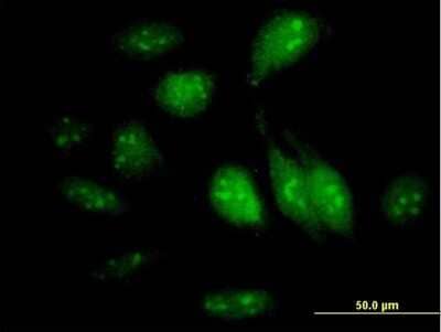 Immunocytochemistry/ Immunofluorescence: GTPBP4 Antibody [H00023560-B01P]