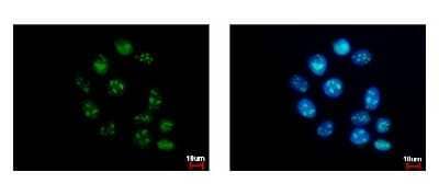 Immunocytochemistry/ Immunofluorescence: GTPBP4 Antibody [NBP2-16766]