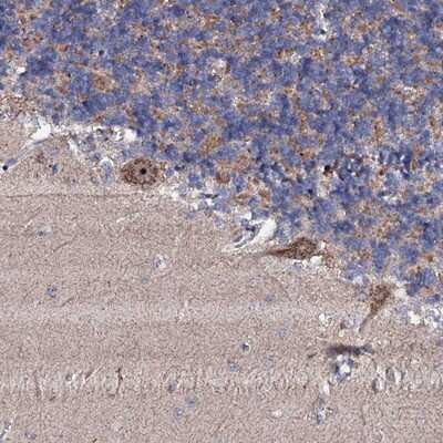 Immunohistochemistry-Paraffin: GTPBP4 Antibody [NBP1-85454]