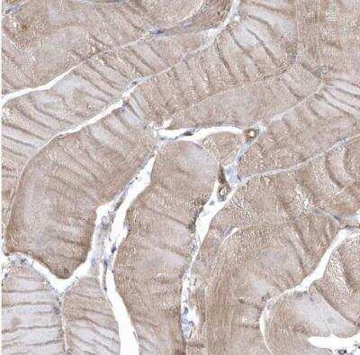 Immunohistochemistry-Paraffin: GTPBP6 Antibody [NBP1-83631]