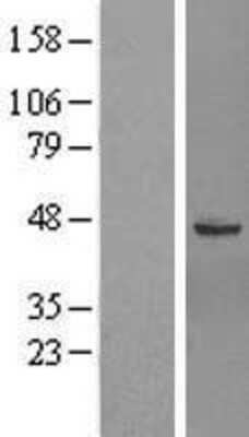 Western Blot: GTPBP6 Overexpression Lysate [NBL1-11402]