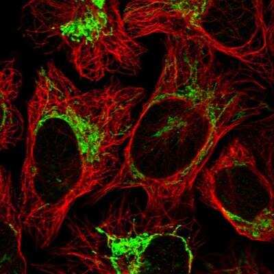 Immunocytochemistry/ Immunofluorescence: GTPBP8 Antibody [NBP1-81679]