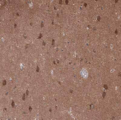 Immunohistochemistry-Paraffin: GTPBP9 Antibody [NBP1-89725]