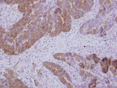 Immunohistochemistry-Paraffin: GTPBP9 Antibody [NBP2-16767]