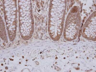Immunohistochemistry-Paraffin: GTPBP9 Antibody [NBP2-16768]