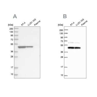 Western Blot: GTPBP9 Antibody [NBP1-89725]