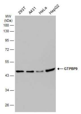 Western Blot: GTPBP9 Antibody [NBP2-16767]