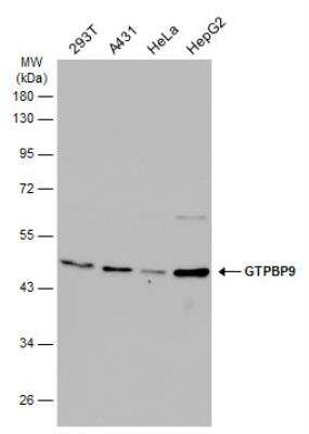 Western Blot: GTPBP9 Antibody [NBP2-16768]