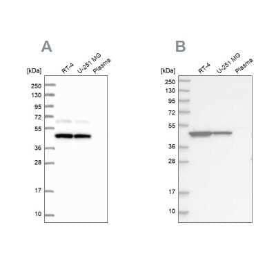 Western Blot: GTPBP9 Antibody [NBP2-58957]