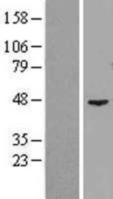 Western Blot: GTPBP9 Overexpression Lysate [NBL1-13922]