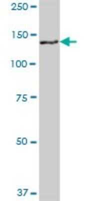 Western Blot: GTSE1 Antibody [H00051512-B01P]