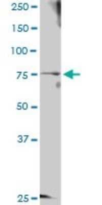 Western Blot: GTSE1 Antibody [H00051512-D01P]