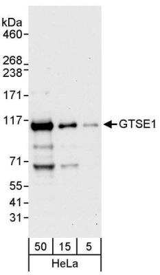 Western Blot: GTSE1 Antibody [NBP1-30058]