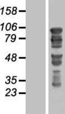 Western Blot: GTSE1 Overexpression Lysate [NBL1-11404]