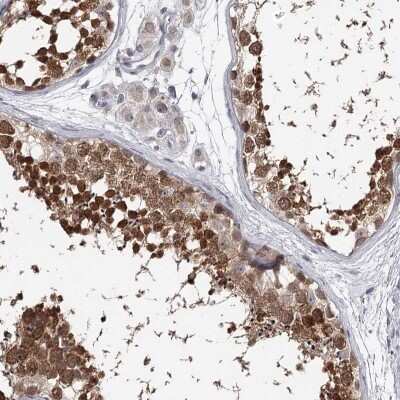 Immunohistochemistry-Paraffin: GTSF1 Antibody [NBP2-32625]