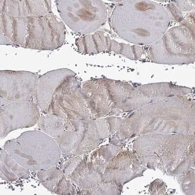 Immunohistochemistry-Paraffin: GTSF1 Antibody [NBP1-83934]