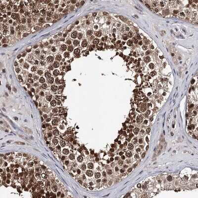 Immunohistochemistry-Paraffin: GTSF1 Antibody [NBP1-83934]