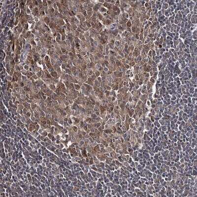 Immunohistochemistry-Paraffin: GTSF1 Antibody [NBP1-83934]