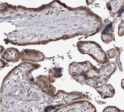 Immunohistochemistry-Paraffin: GTSF1 Antibody [NBP2-32625]
