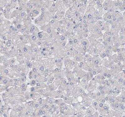 Immunohistochemistry-Paraffin: GTSF1 Antibody [NBP2-32625]