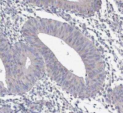 Immunohistochemistry-Paraffin: GTSF1 Antibody [NBP2-32625]