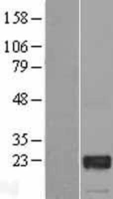 Western Blot: GTSF1 Overexpression Lysate [NBL1-11405]