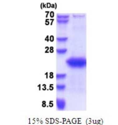 SDS-PAGE: Recombinant Human GTSF1 His Protein [NBP2-51643]