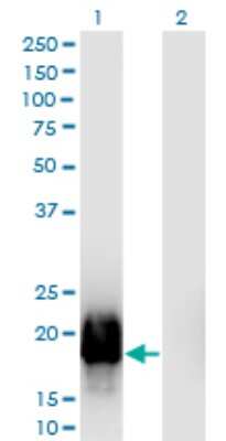 Western Blot: GTSF1L Antibody (5E7) [H00149699-M03]