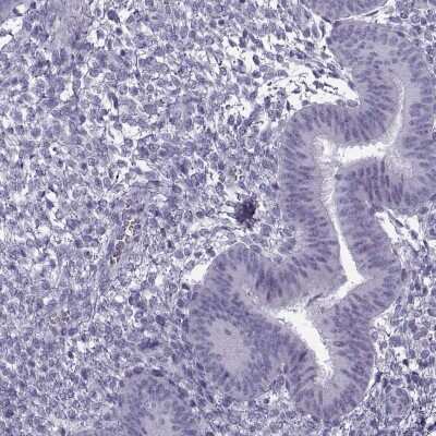 Immunohistochemistry-Paraffin: GTSF1L Antibody [NBP2-38734]