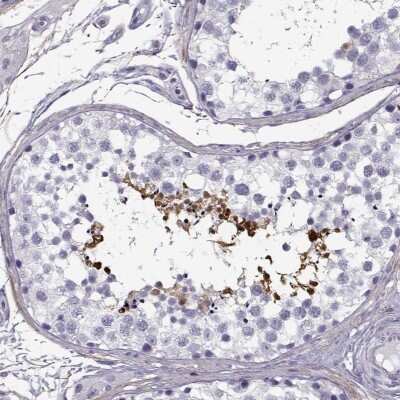 Immunohistochemistry-Paraffin: GTSF1L Antibody [NBP2-38734]