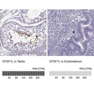 Immunohistochemistry-Paraffin: GTSF1L Antibody [NBP2-38734]