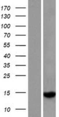 Western Blot: GTSF1L Overexpression Lysate [NBP2-08702]