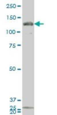 Western Blot: GUCY2C Antibody (1B11) [H00002984-M02]