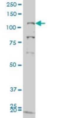 Western Blot: GUCY2C Antibody (1E1) [H00002984-M05]